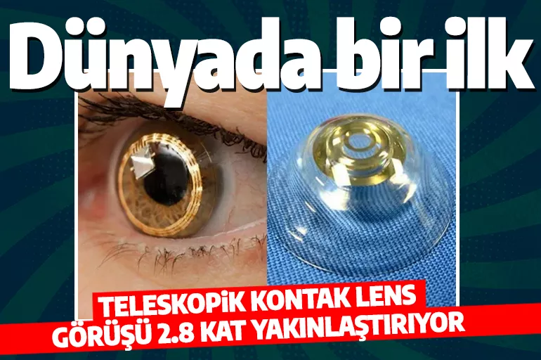 Bilim adamlarından müthiş buluş! 'Teleskopik kontak lens' sayesinde 2.8 kat daha yakın görüntü