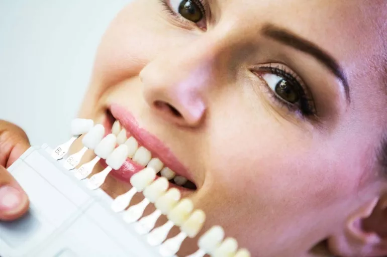 Gülüşünüzü yeniden tasarlamaya ne dersiniz? Son yılların modası diş estetiği nedir?