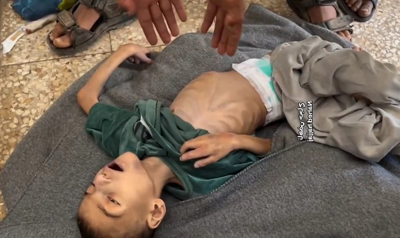 İsrail açlığa mahkum etti! Gazzeli minik Mustafa annesinin kollarında açlıktan öldü