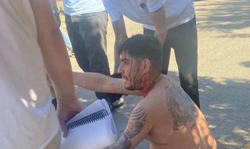 İstanbul'da dizi setini taradılar! Ünlü oyuncu başından yaralandı kanlar içinde kaldı!