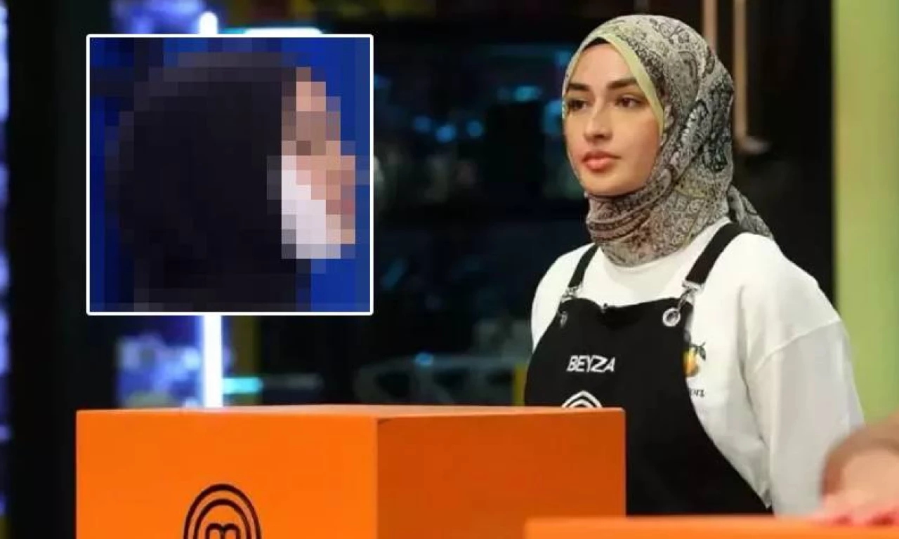 MasterChef Beyza'nın son hali nasıl? Beyza'nın yüzünde iz kalacak mı?